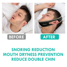 Load image into Gallery viewer, Twin Pack Anti-Snore Sleep Solutions Strap
